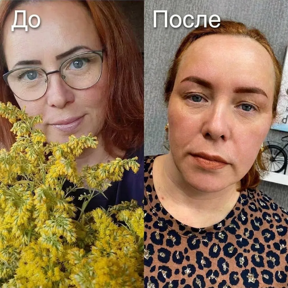 Результат процедуры до и после